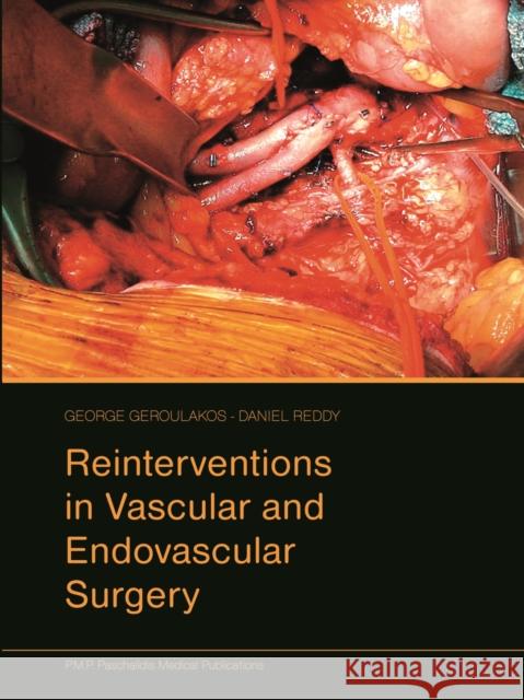 Reinterventions in Vascular and Endovascular Surgery Geroulakos, G. 9789603995401 Paschalidis Medical Publications - książka