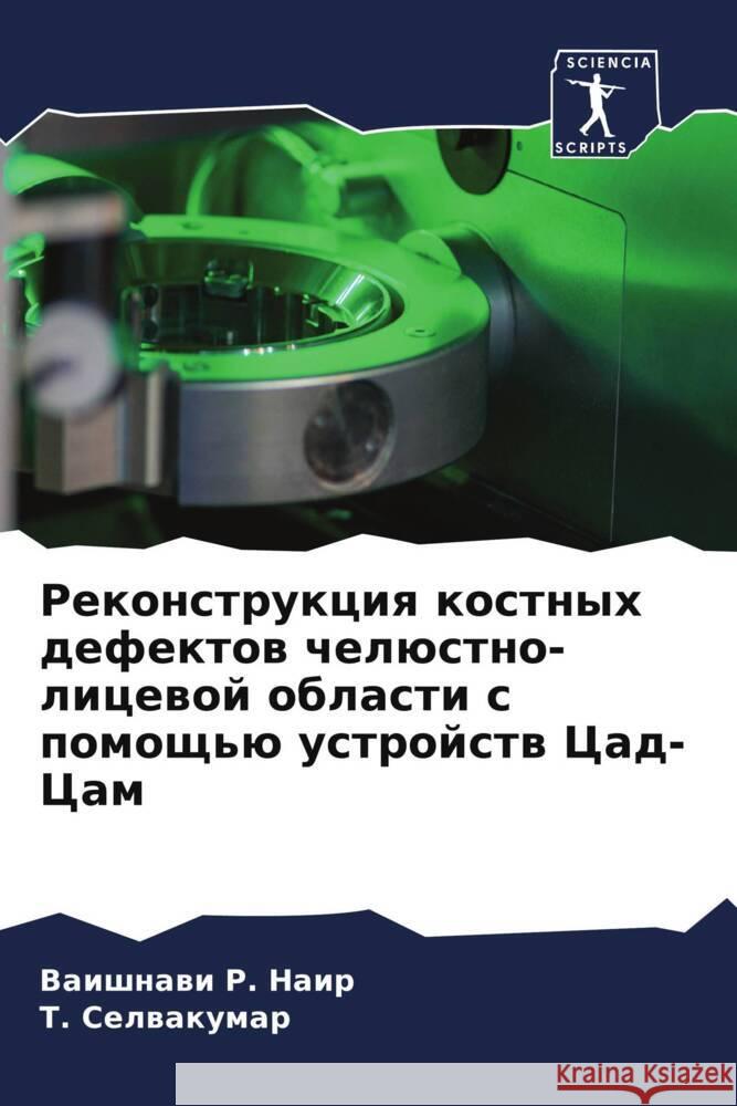 Rekonstrukciq kostnyh defektow chelüstno-licewoj oblasti s pomosch'ü ustrojstw Cad-Cam R. Nair, Vaishnawi, Selwakumar, T. 9786206517818 Sciencia Scripts - książka