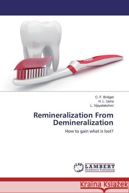 Remineralization From Demineralization : How to gain what is lost? Bridget, C. F.; Usha, H. L.; Vijayalakshmi, L. 9786137437155 LAP Lambert Academic Publishing - książka