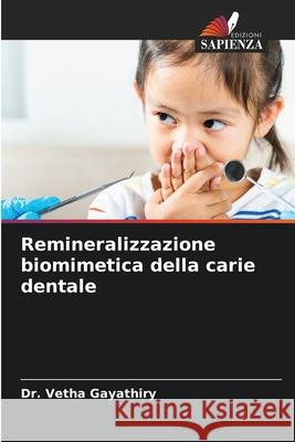 Remineralizzazione biomimetica della carie dentale Vetha Gayathiry 9786207525782 Edizioni Sapienza - książka