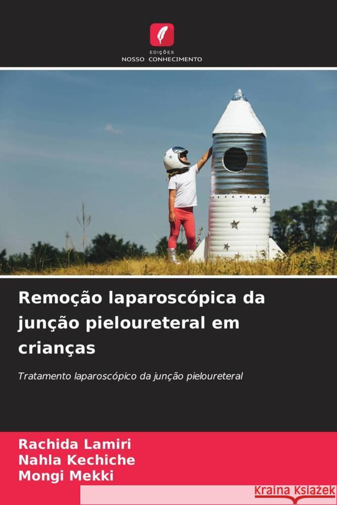 Remoção laparoscópica da junção pieloureteral em crianças Lamiri, Rachida, kechiche, Nahla, Mekki, Mongi 9786208178178 Edições Nosso Conhecimento - książka