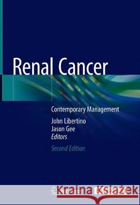 Renal Cancer: Contemporary Management Libertino, John a. 9783030243777 Springer - książka