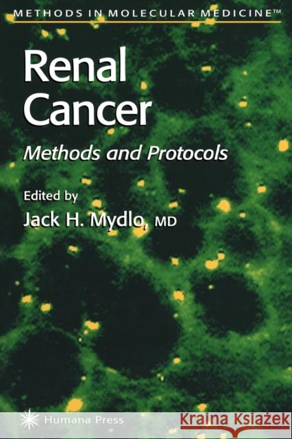 Renal Cancer: Methods and Protocols Mydlo, Jack H. 9781617372087 Springer - książka