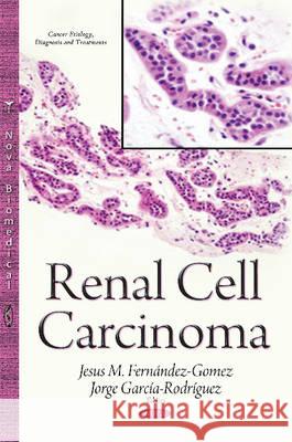 Renal Cell Carcinoma Jesus M Fernandez-Gomez, Jorge Garcia-Rodriguez 9781634824958 Nova Science Publishers Inc - książka