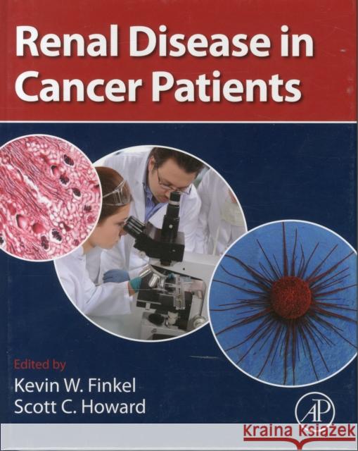 Renal Disease in Cancer Patients Kevin Finkel 9780124159488 ACADEMIC PRESS - książka