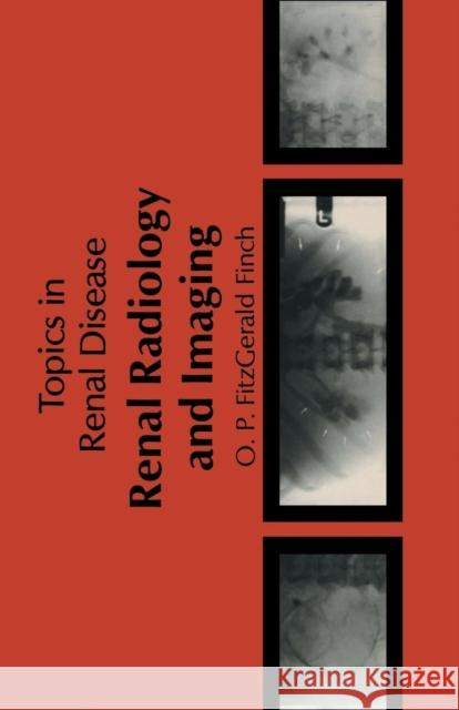 Renal Radiology and Imaging O. P. Fitzgerald-Finch 9789400980747 Springer - książka