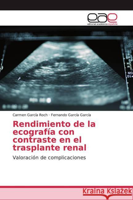 Rendimiento de la ecografía con contraste en el trasplante renal : Valoración de complicaciones García Roch, Carmen; García García, Fernando 9783844348750 Editorial Académica Española - książka