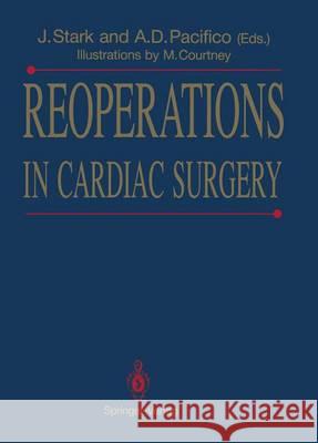 Reoperations in Cardiac Surgery Jarda Stark Al Pacifico M. Courtney 9781447116905 Springer - książka