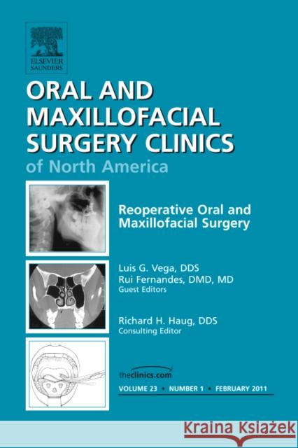 Reoperative Oral and Maxillofacial Surgery, an Issue of Oral and Maxillofacial Surgery Clinics: Volume 23-1 Fernandes, Rui 9781455704767 W.B. Saunders Company - książka