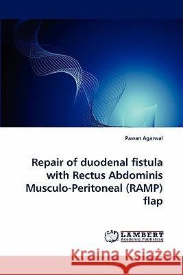 Repair of Duodenal Fistula with Rectus Abdominis Musculo-Peritoneal (Ramp) Flap  9783843387996 LAP Lambert Academic Publishing AG & Co KG - książka