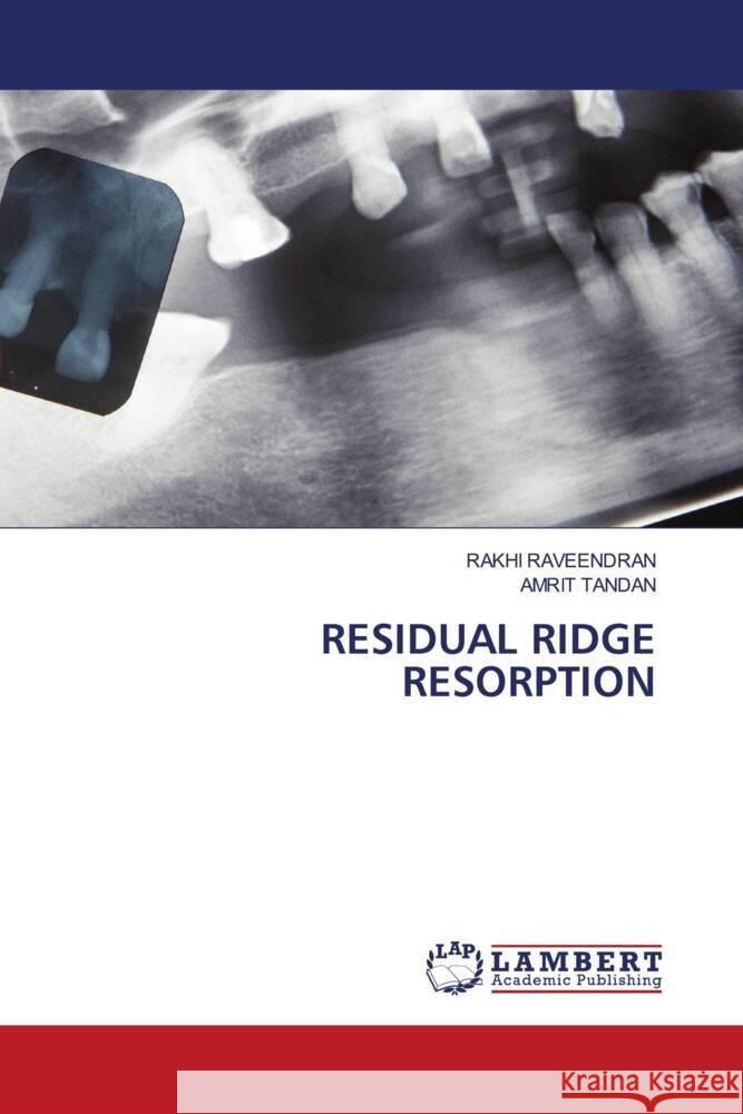 RESIDUAL RIDGE RESORPTION RAVEENDRAN, RAKHI, Tandan, Amrit 9786206183549 LAP Lambert Academic Publishing - książka