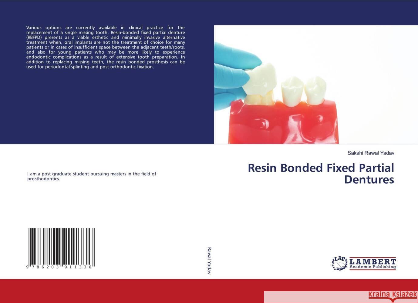Resin Bonded Fixed Partial Dentures Rawal Yadav, Sakshi 9786203911336 LAP Lambert Academic Publishing - książka
