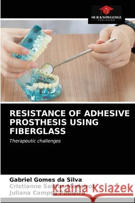 Resistance of Adhesive Prosthesis Using Fiberglass Gabriel Gomes D Cristianne Santo Juliana Campo 9786203688719 Our Knowledge Publishing - książka