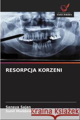 RESORPCJA KORZENI Sajan, Sanaya, Muddaiah, Sunil 9786202329460 Wydawnictwo Nasza Wiedza - książka