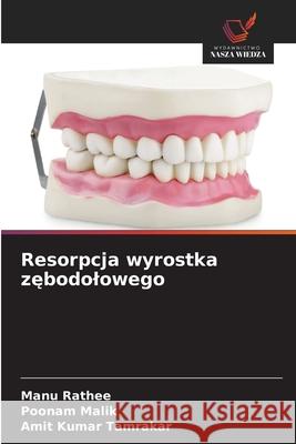 Resorpcja wyrostka zebodolowego Rathee, Manu, Malik, Poonam, Tamrakar, Amit Kumar 9786209232107 Wydawnictwo Nasza Wiedza - książka