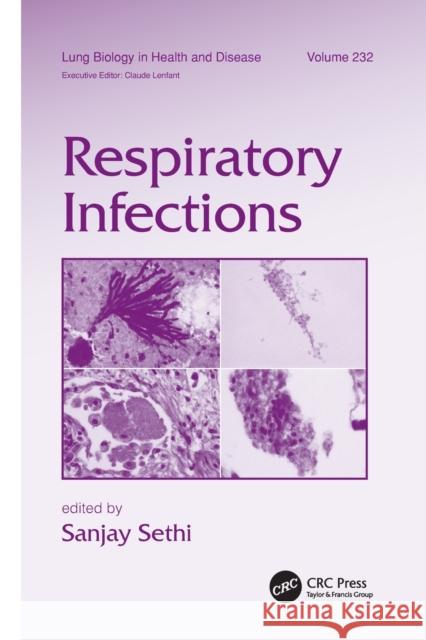 Respiratory Infections  9781138114890 Taylor and Francis - książka