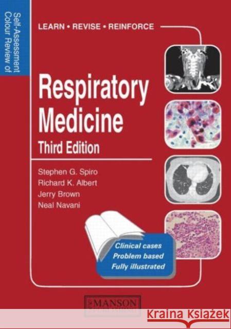 Respiratory Medicine : Self-Assessment Colour Review, Third Edition Stephen G Spiro 9781840761399  - książka