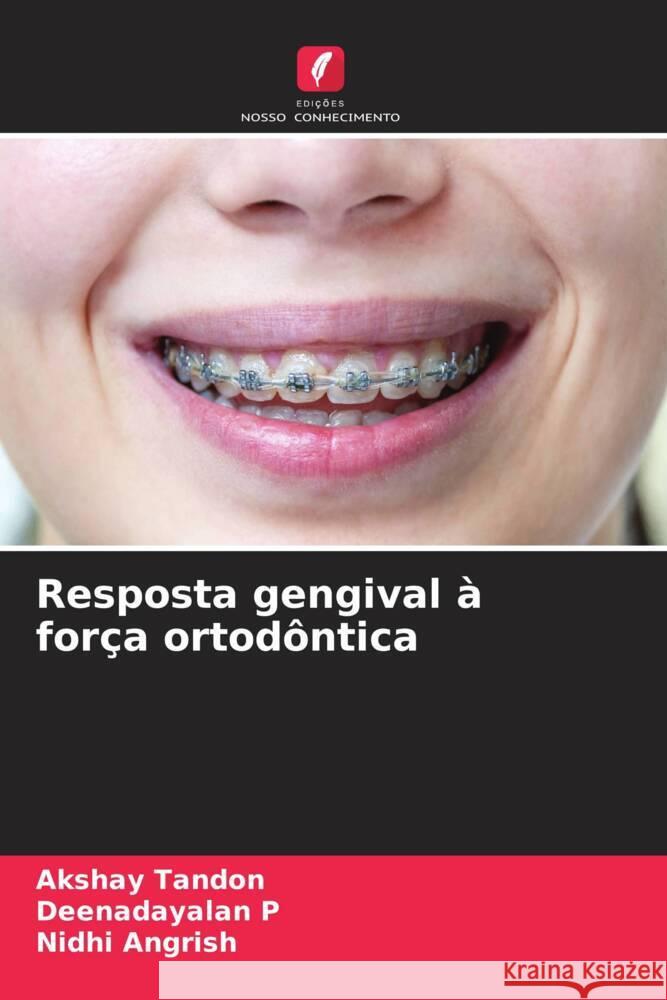 Resposta gengival à força ortodôntica Tandon, Akshay, P, Deenadayalan, Angrish, Nidhi 9786205148815 Edições Nosso Conhecimento - książka