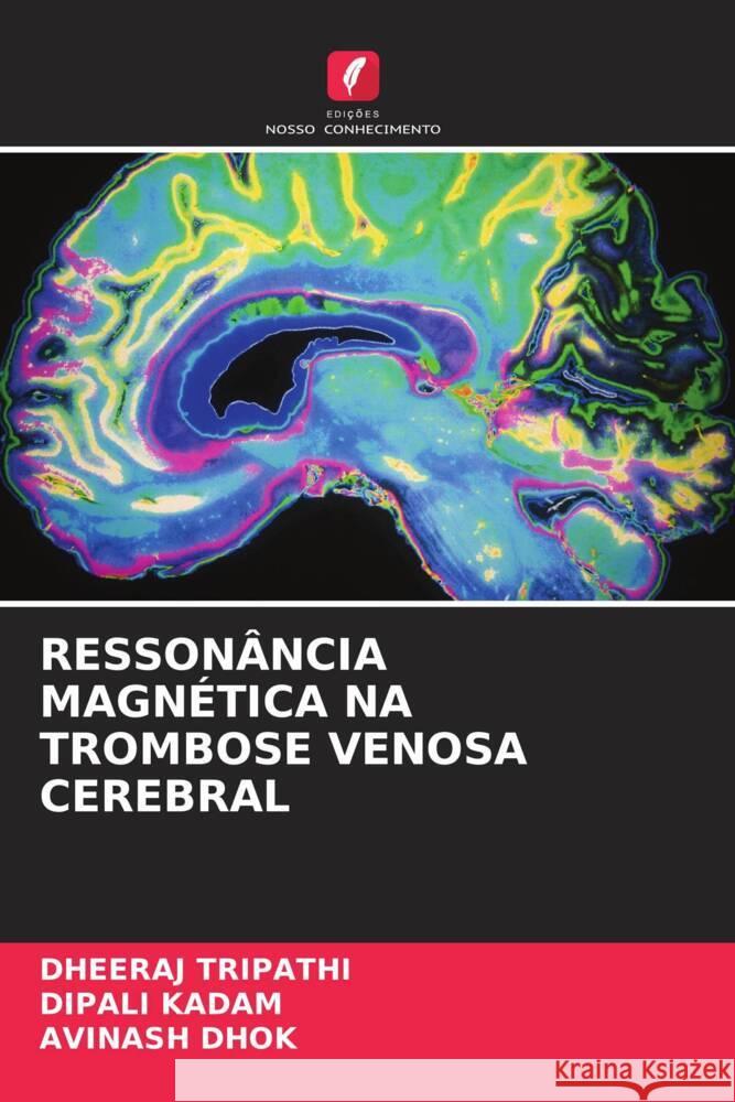 RESSONÂNCIA MAGNÉTICA NA TROMBOSE VENOSA CEREBRAL Tripathi, Dheeraj, Kadam, Dipali, Dhok, Avinash 9786204902807 Edições Nosso Conhecimento - książka