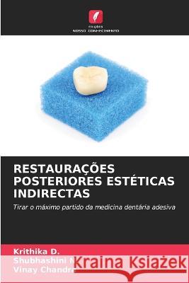 Restauracoes Posteriores Esteticas Indirectas Krithika D Shubhashini N Vinay Chandra 9786206049418 Edicoes Nosso Conhecimento - książka