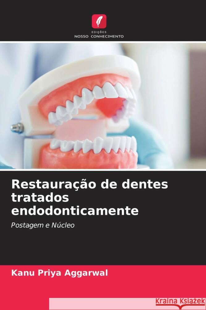 Restauração de dentes tratados endodonticamente Aggarwal, Kanu Priya 9786206563709 Edições Nosso Conhecimento - książka