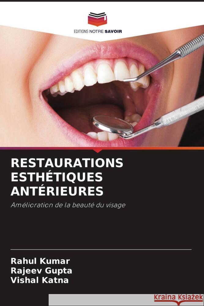 RESTAURATIONS ESTHÉTIQUES ANTÉRIEURES Kumar, Rahul, Gupta, Rajeev, Katna, Vishal 9786204407326 Editions Notre Savoir - książka