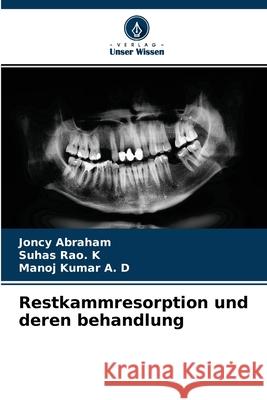 Restkammresorption und deren behandlung Joncy Abraham, Suhas Rao K, Manoj Kumar a D 9786204130378 Verlag Unser Wissen - książka