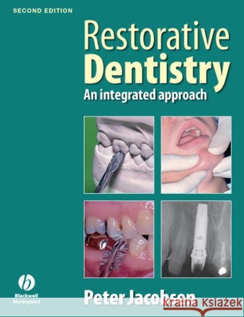 Restorative Dentistry 2e Jacobsen, Peter 9781405167994 Wiley-Blackwell - książka