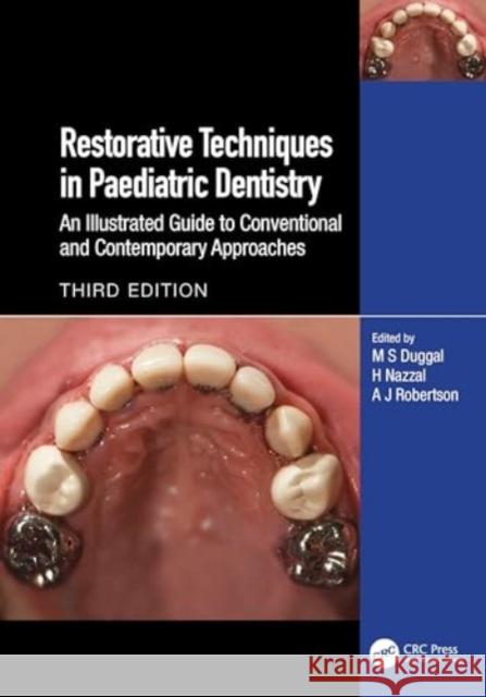 Restorative Techniques in Paediatric Dentistry: An Illustrated Guide to Conventional and Contemporary Approaches  9781032132303 Taylor & Francis Ltd - książka