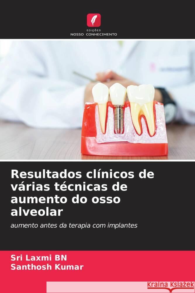 Resultados cl?nicos de v?rias t?cnicas de aumento do osso alveolar Sri Laxmi Bn Santhosh Kumar 9786207281091 Edicoes Nosso Conhecimento - książka