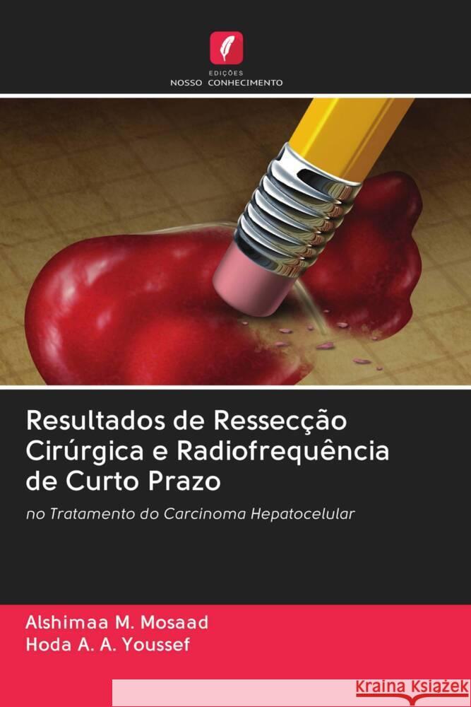 Resultados de Ressecção Cirúrgica e Radiofrequência de Curto Prazo M. Mosaad, Alshimaa, A. A. Youssef, Hoda 9786203089127 Edicoes Nosso Conhecimento - książka