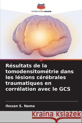 Resultats de la tomodensitometrie dans les lesions cerebrales traumatiques en correlation avec le GCS Ihssan S Nema   9786206067443 Editions Notre Savoir - książka