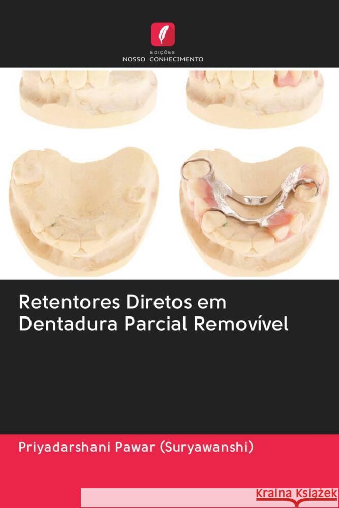 Retentores Diretos em Dentadura Parcial Removível Pawar (Suryawanshi), Priyadarshani 9786203010442 Edicoes Nosso Conhecimento - książka