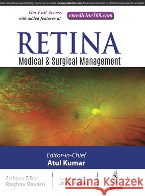 Retina Kumar, Atul 9789352702947 Jp Medical Ltd - książka