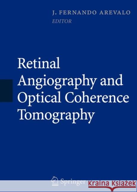 Retinal Angiography and Optical Coherence Tomography J. Fernando Arevalo 9780387689869 Springer - książka