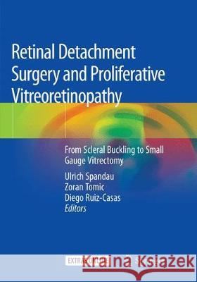 Retinal Detachment Surgery and Proliferative Vitreoretinopathy: From Scleral Buckling to Small Gauge Vitrectomy Spandau, Ulrich 9783030087005 Springer Nature Switzerland AG - książka