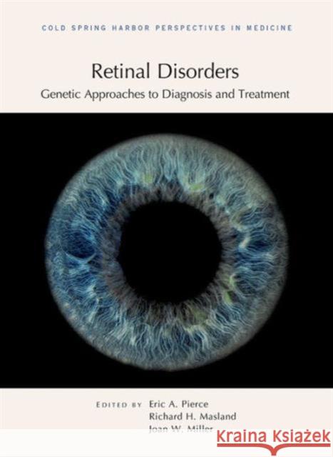 Retinal Disorders: Genetic Approaches to Diagnosis and Treatment  9781621820178 Cold Spring Harbor Laboratory Press - książka