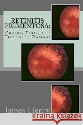 Retinitis Pigmentosa: Causes, Tests, and Treatment Options James Henr Jeremy Norvill 9781475103878 Createspace - książka