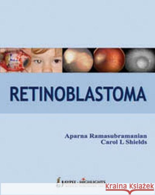 Retinoblastoma  9789350257845 Jaypee Brothers Medical Publishers - książka