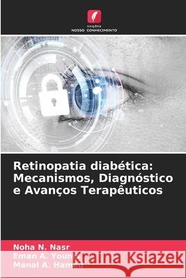 Retinopatia diabética: Mecanismos, Diagnóstico e Avanços Terapêuticos Nasr, Noha N., Younis, Eman A., Hamed, Manal A. 9786208476373 Edições Nosso Conhecimento - książka