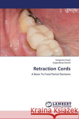 Retraction Cords Goyal Sangeeta                           Kansal Gagandeep 9783659428838 LAP Lambert Academic Publishing - książka