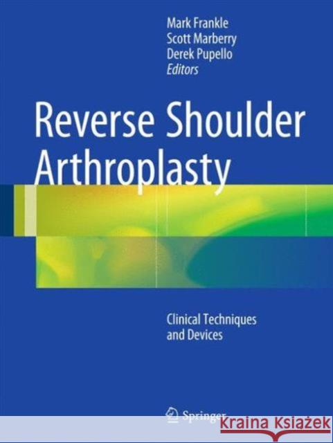 Reverse Shoulder Arthroplasty: Clinical Techniques and Devices Frankle, Mark 9783319208398 Springer - książka