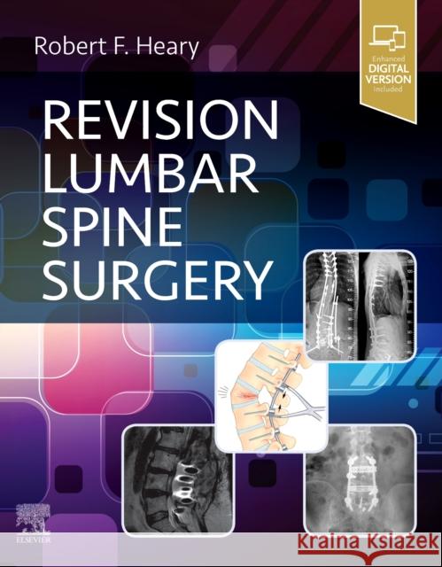 Revision Lumbar Spine Surgery Robert F. Heary 9780323712019 Elsevier - Health Sciences Division - książka