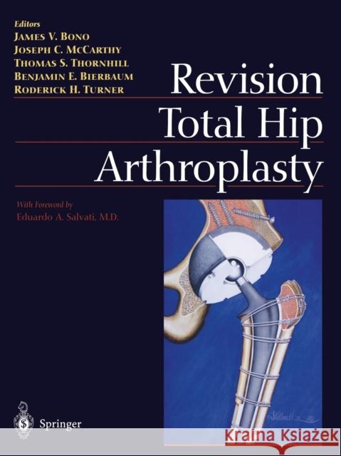 Revision Total Hip Arthroplasty James V. Bono Joseph C. McCarthy Thomas S. Thornhill 9781461271314 Springer - książka