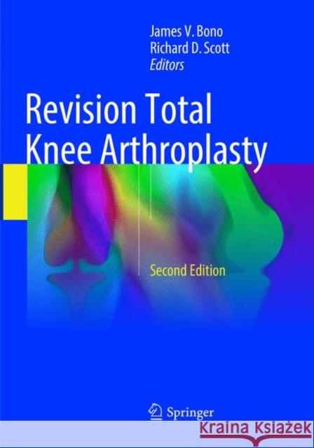 Revision Total Knee Arthroplasty James V. Bono Richard D. Scott 9783319884165 Springer - książka