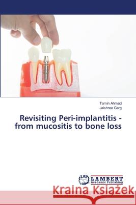 Revisiting Peri-implantitis - from mucositis to bone loss Ahmad, Tamin, Garg, Jaishree 9786207805563 LAP Lambert Academic Publishing - książka