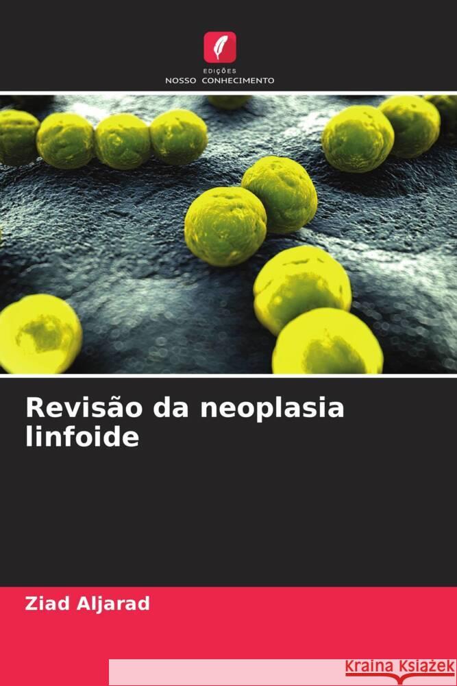 Revisão da neoplasia linfoide Aljarad, Ziad 9786208182014 Edições Nosso Conhecimento - książka