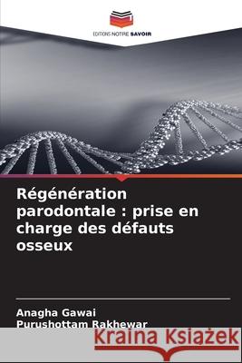 Régénération parodontale : prise en charge des défauts osseux Gawai, Anagha, Rakhewar, Purushottam 9786208808501 Editions Notre Savoir - książka