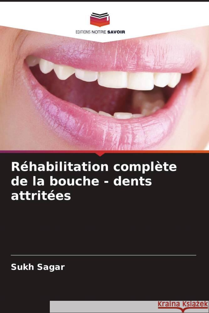 Réhabilitation complète de la bouche - dents attritées Sagar, Sukh 9786205201398 Editions Notre Savoir - książka