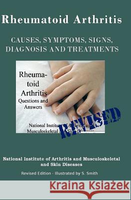 Rheumatoid Arthritis: Causes, Symptoms, Signs, Diagnosis and Treatments - Revised Edition - Illustrated by S. Smith National Institut S. Smith S. Smith 9781469986685 Createspace - książka